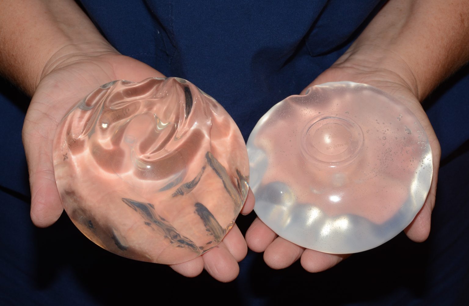 Saline vs. Silicone