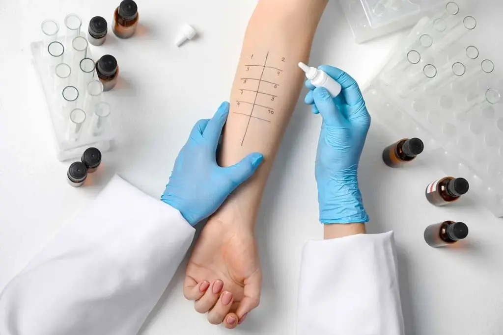 Exploring Methods in Allergy Testing and Diagnosis Allergy Testing