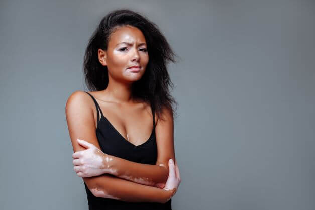 The Impact of Skin Conditions on Overall Well-Being Impact of Skin Conditions on Overall Well-Being