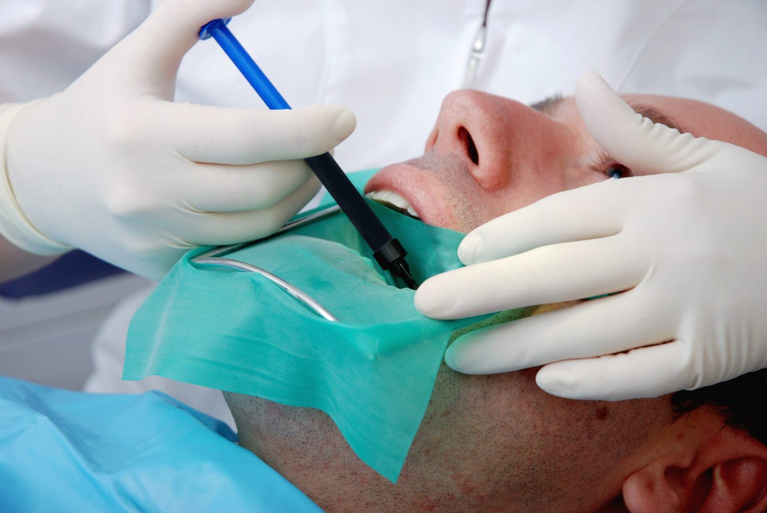 Getting a Root Canal